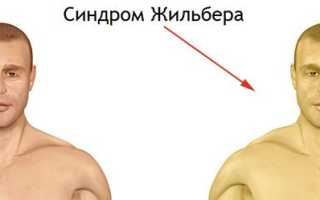 Аллергия на парацетамол