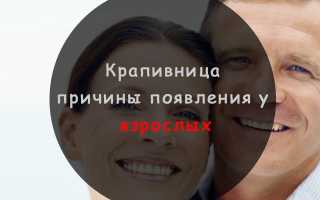Как быстро проходит крапивница у взрослых