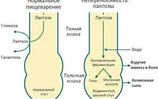 Непереносимость грудного молока у новорожденных